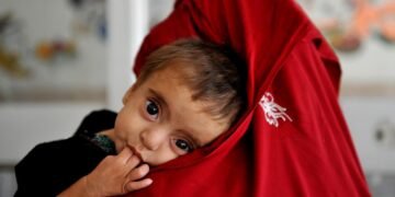 خلق‌ارا آذیق_آوقت دستوری: افغانستان‌ده تۉرت میلیون باله و آنه توییب آوقت‌لنمسلیککه چلینگن