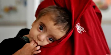 افغانستان‌ده اۉچ میلیون باله توییب-آوقت‌لنمسلیککه چلینگن