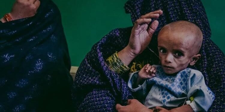 افغانستان‌ده اخیرگی آی‌لر ۲۸ مینگ‌دن آرتیق باله توییب-آوقت‌لنمسلیککه چلینگن