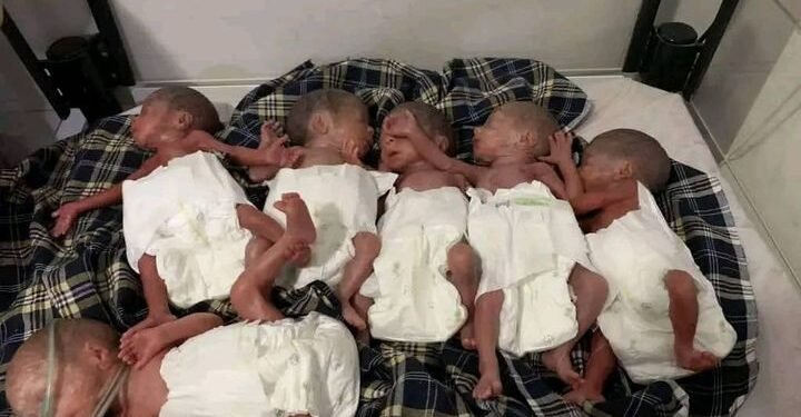 جوزجان‌ کسلخانه‌لریدن بیریده توغیلگن آلتی ایگیزک وفات قیلگن