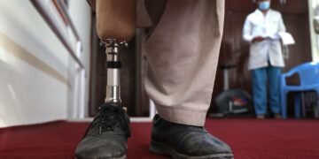 یوناما: افغانستان‌ده ۱.۵ میلیون کیشی ناگران دیر