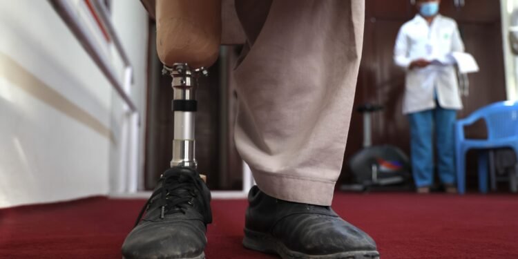 یوناما: افغانستان‌ده ۱.۵ میلیون کیشی ناگران دیر