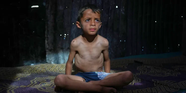 غزه‌ده ۲۹۰ مینگ‌گه یقین باله اۉلیم یاقه‌سیده قرار تاپکن