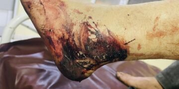 بدخشان‌ده اهالی‌گه قرشی ظلم؛ قیشلاق اربابی‌گه قرشی‌لیک کۉرستگن اهالی اۉققه توتیلیب حبسگه آلیندی