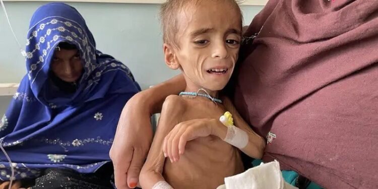 افغانستانده آزوقه یېتیشماوچیلیگی: عیاللر و بالهلر آرهسیده وضعیت خواطرلی درجهده یامانلشماقده