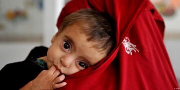 افغانستان‌ده آزیقلنیش یېتیشماوچیلیگی: یونیسف ۸۵۷ مینگ باله دواله‌نیشگه محتاج