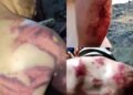 تورکیه چېگره‌سیده مهاجرلر احوالی؛ کلتک‌لنگن ییگیت: بیزنینگ حکومت‌میز بۉلگنده شونده‌ی کلتک‌لنمس اېدیک