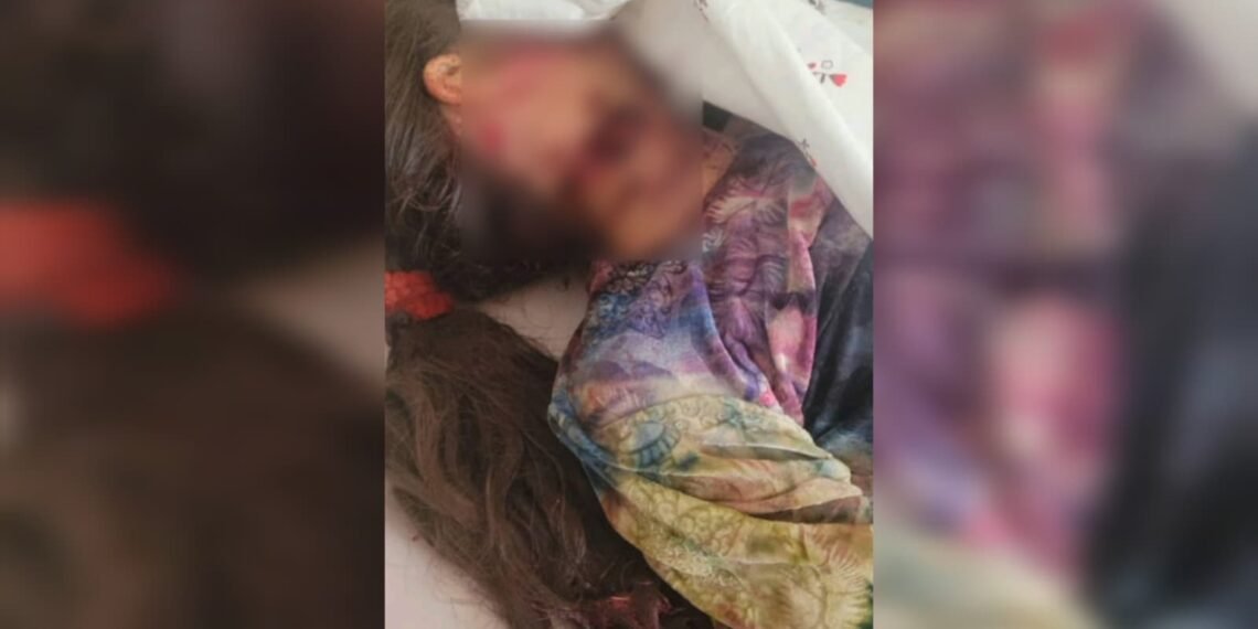 عیاللرگه نسبتن دهشت‌لی ظلم؛ سرپل‌ده ۱۱ یاشلی بیر قیز دهشتلی طرزده اۉلدیریلگن