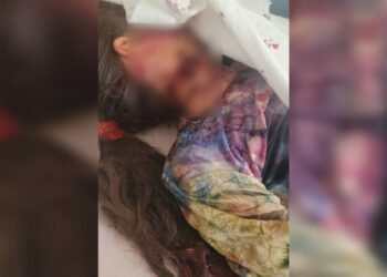 عیاللرگه نسبتن دهشت‌لی ظلم؛ سرپل‌ده ۱۱ یاشلی بیر قیز دهشتلی طرزده اۉلدیریلگن
